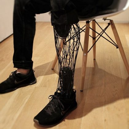 3D Printed Prosthetics